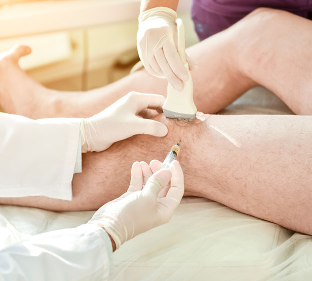 Cortisone Shots in Knee: Everything You Need to Know