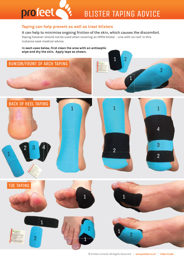 How to Avoid Blisters in Marathon?