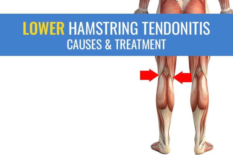 Running Hamstring Pain: Causes, Treatment And Prevention Plan