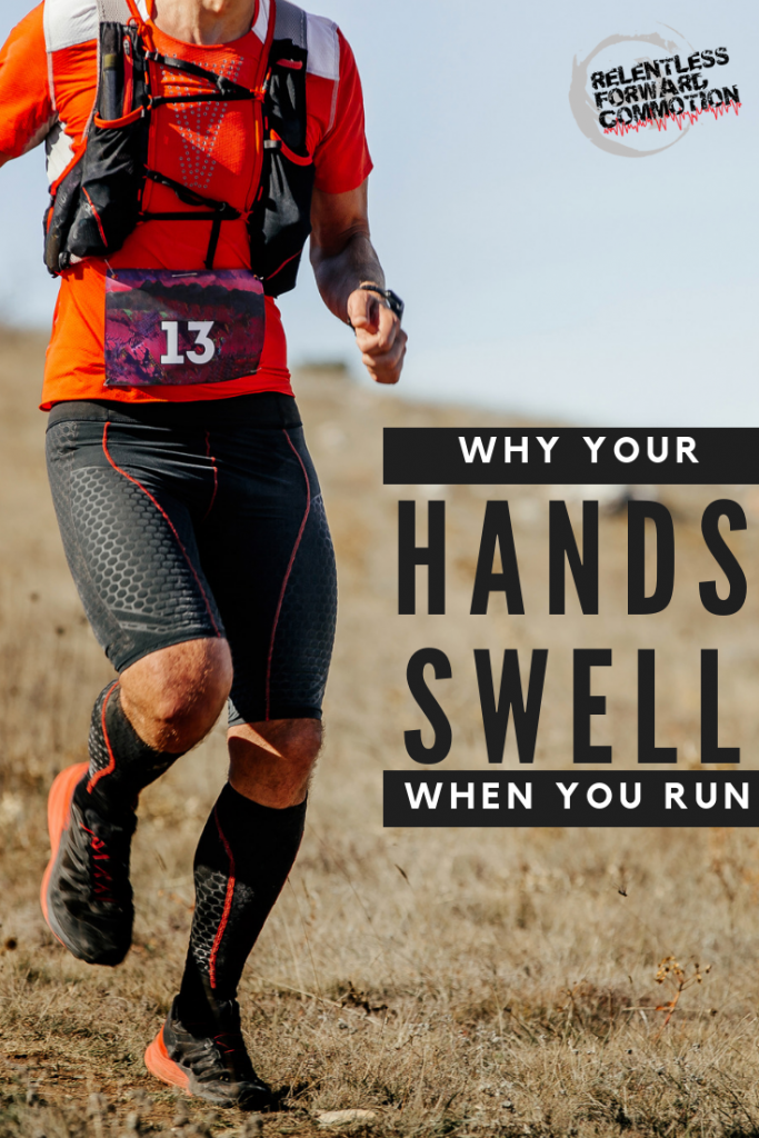 Why Do Hands Swell While Running?