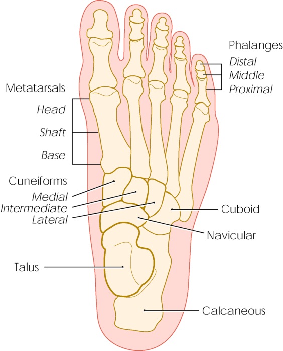 Can I Self Treat a Stress Fracture?