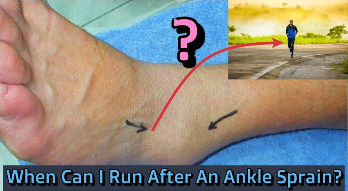 How Long Until I Can Run After a Sprained Ankle?