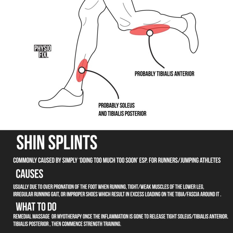 Should You Massage Shin Splints?